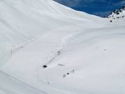 Easy slope 63