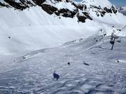 Mogul slope