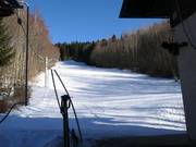 Button lift and slope