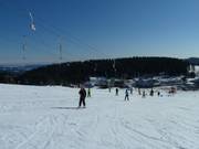 Resilift II - J-bar