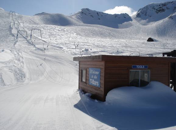 T-Bar 1