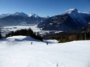 Wetterstein descent