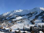 View of the Oberjoch ski area