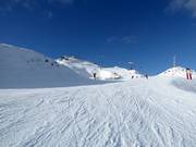 Slope M1