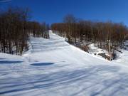 Knowlton slope