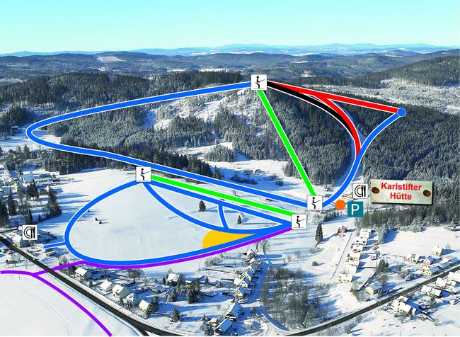 Aichelberglifte – Karlstift Aichelberglifte – Karlstift