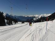 Balisalp - T-bar