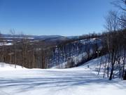 Albany slope