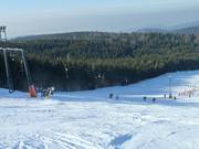 Mehliskopf 2 - T-bar